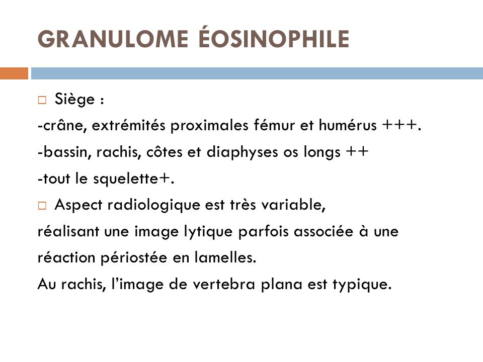 Imagerie Des Tumeurs Osseuses Benignes Ppt Video Online T L Charger