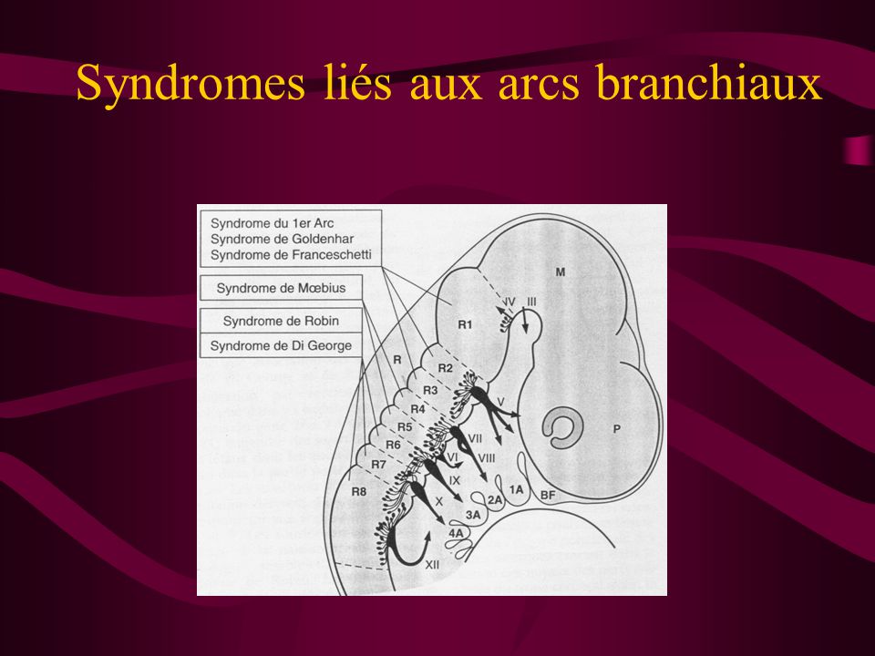 Syndromes liés aux arcs branchiaux