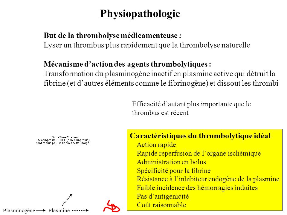 Physiopathologie But de la thrombolyse médicamenteuse :
