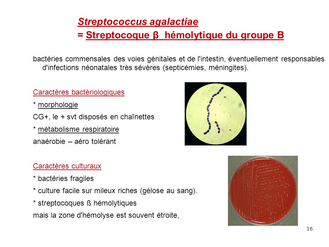 Тест на стрептококки в аптеке. Стафилококк агалактия. Streptococcus agalactiae культуральные свойства. Streptococcus agalactiae механизм передачи.
