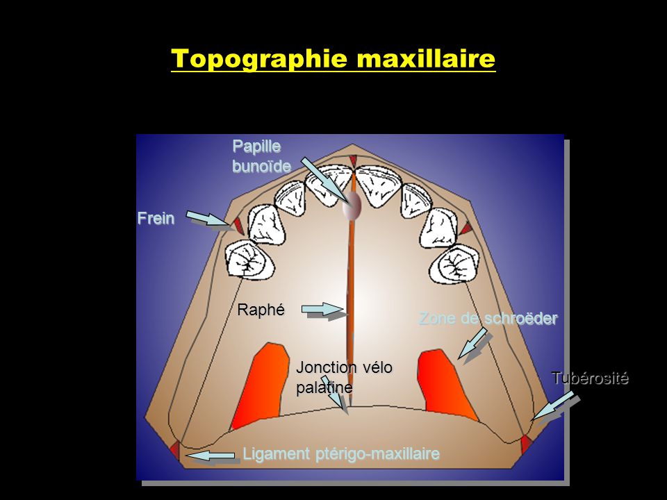 Topographie maxillaire