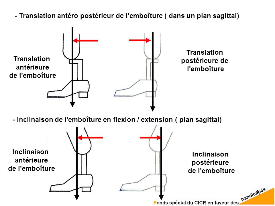 - Translation antéro postérieur de l emboîture ( dans un plan sagittal)