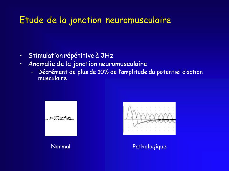 Etude de la jonction neuromusculaire