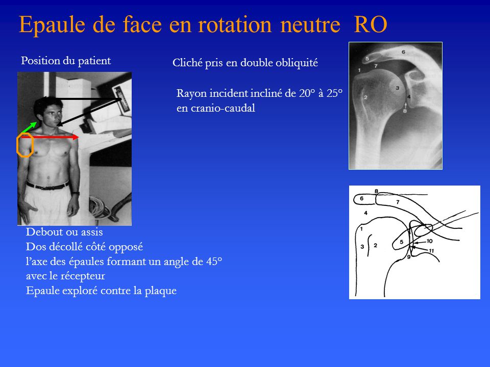 Epaule de face en rotation neutre RO