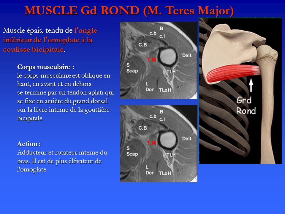 MUSCLE Gd ROND (M. Teres Major)