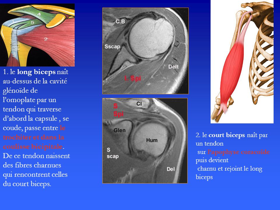 1. le long biceps naît au-dessus de la cavité glénoïde de l’omoplate par un tendon qui traverse d’abord la capsule , se coude, passe entre le trochiter et dans la coulisse bicipitale. De ce tendon naissent des fibres charnues qui rencontrent celles du court biceps.