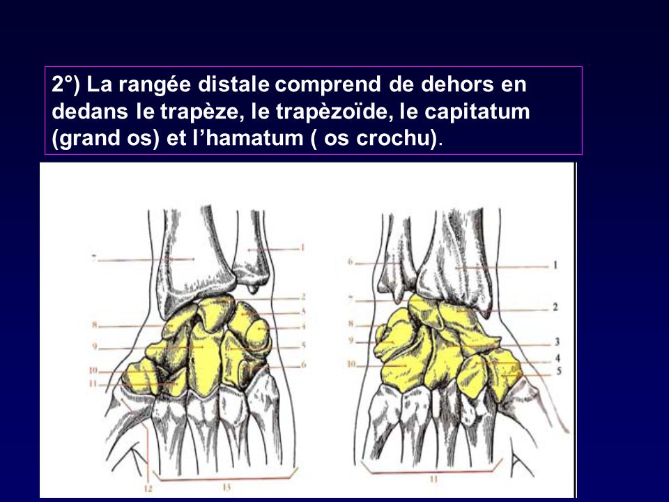 2°) La rangée distale comprend de dehors en dedans le trapèze, le trapèzoïde, le capitatum (grand os) et l’hamatum ( os crochu).