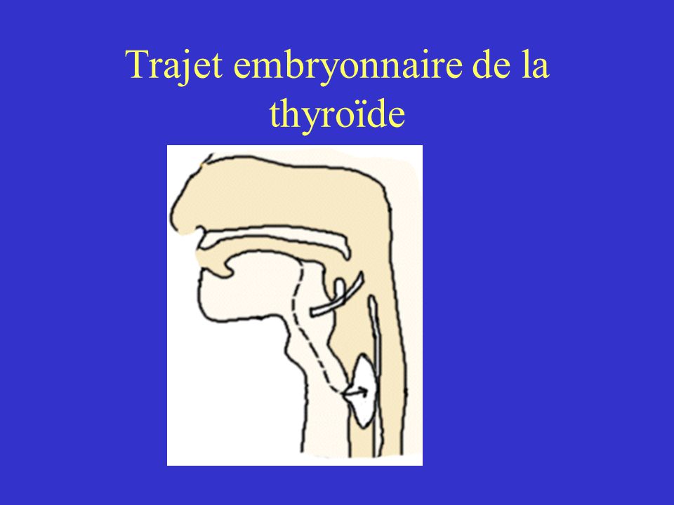 Trajet embryonnaire de la thyroïde