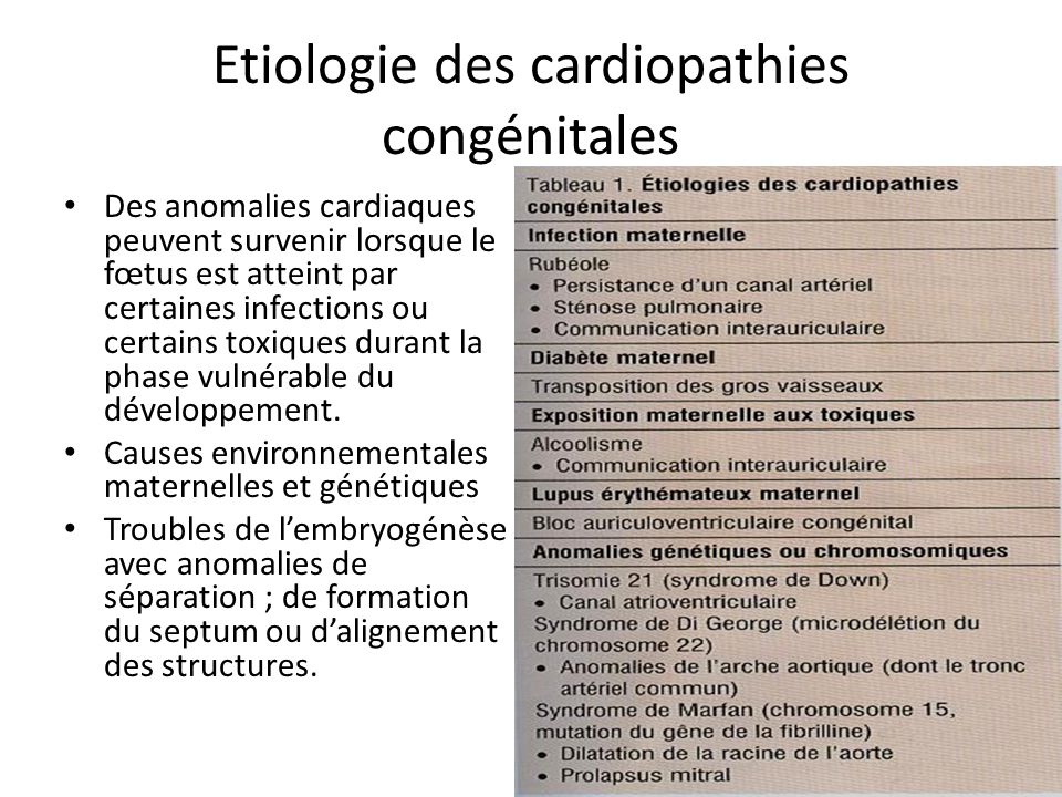 Les cardiopathies congénitales - ppt video online télécharger