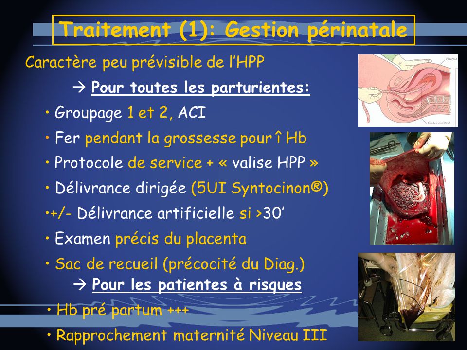 Hémorragie Grave Du Postpartum Ppt Video Online Télécharger 2331