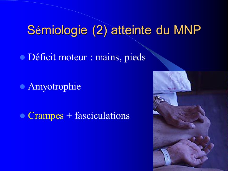 Sémiologie (2) atteinte du MNP