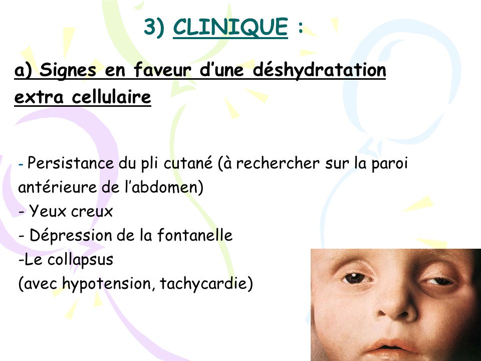 Epilepsies Et Convulsions Ppt Telecharger