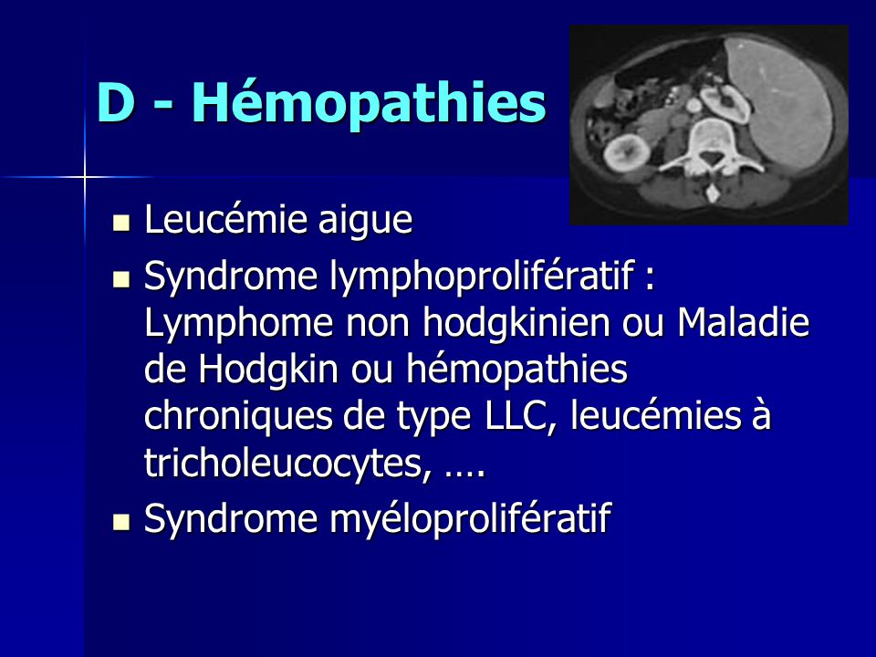 D - Hémopathies Leucémie aigue