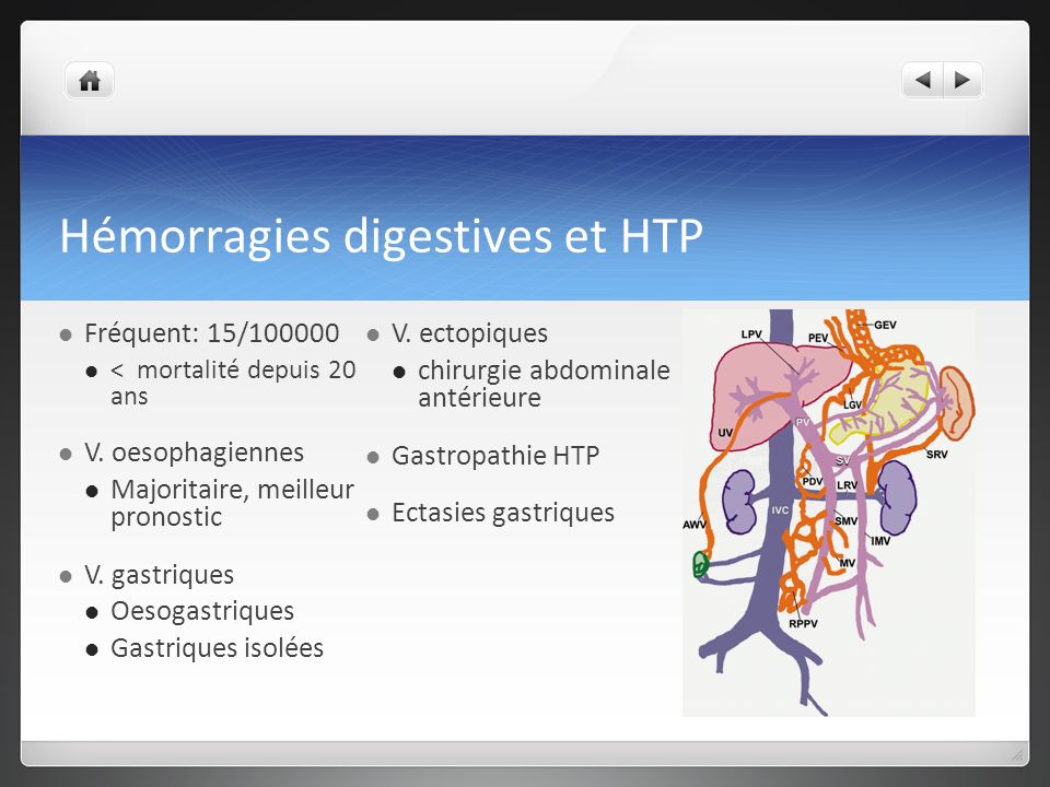 Hémorragies digestives et HTP
