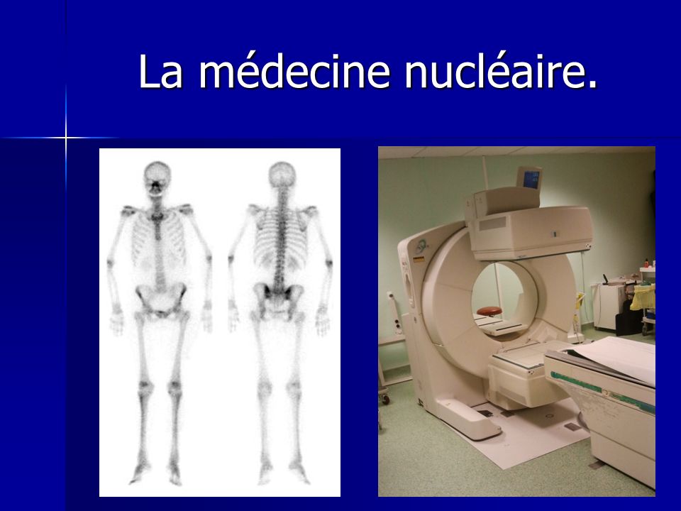La médecine nucléaire.