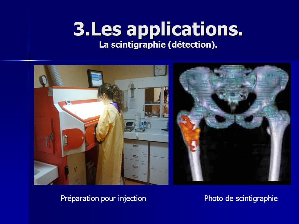 3.Les applications. La scintigraphie (détection).