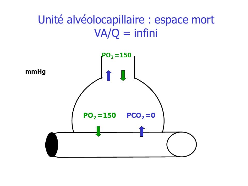 Unité alvéolocapillaire : espace mort VA/Q = infini