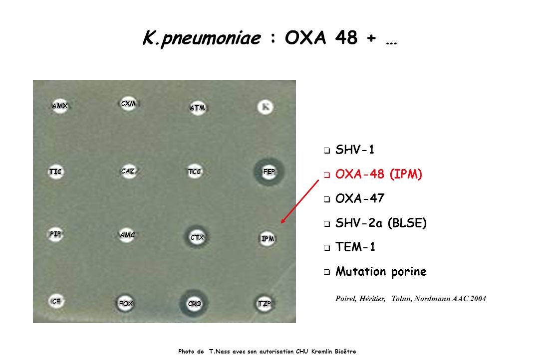 bacterie oxa 48)
