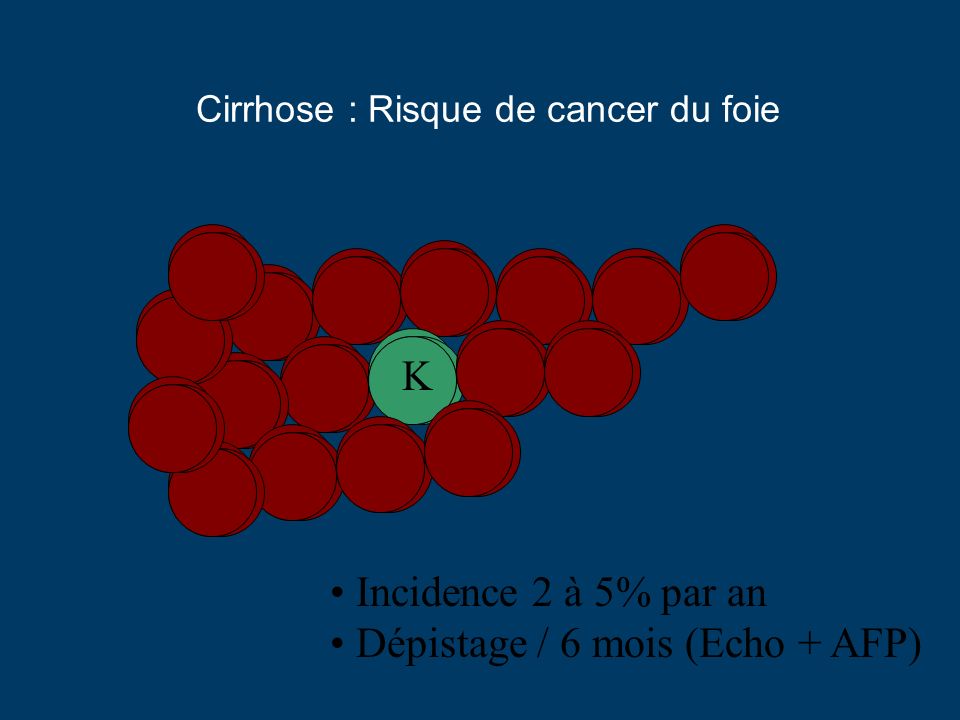 Cirrhose : Risque de cancer du foie