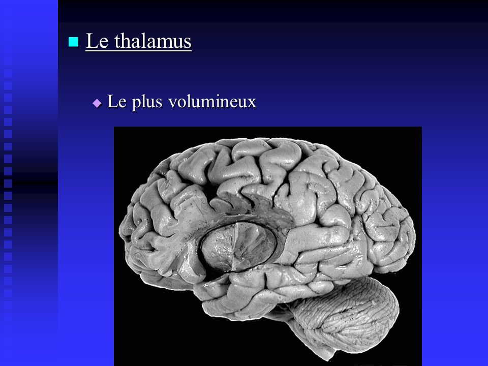Le thalamus Le plus volumineux