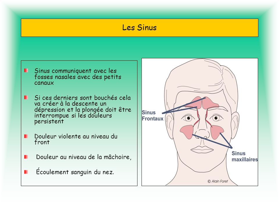 Les Sinus Sinus communiquent avec les fosses nasales avec des petits canaux.