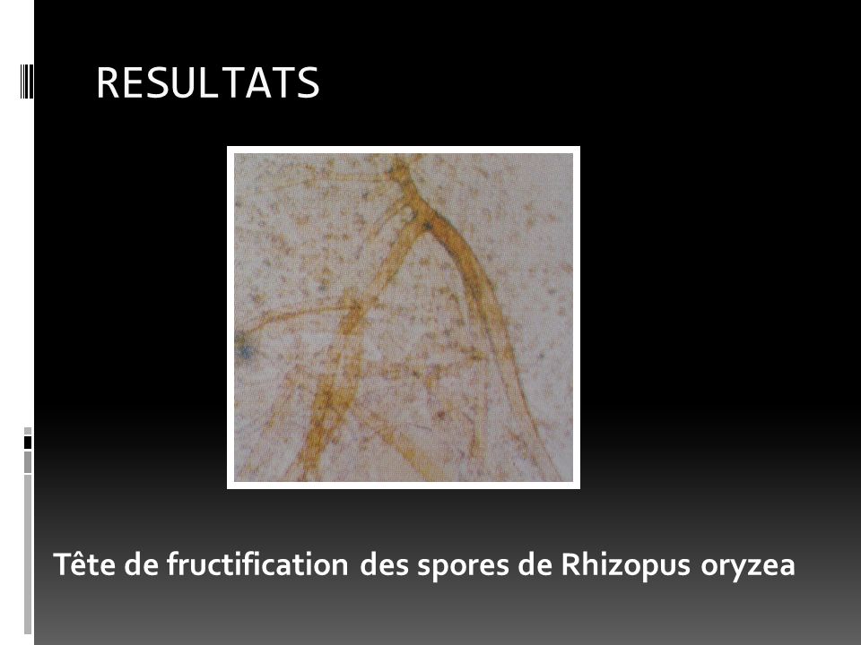 RESULTATS Tête de fructification des spores de Rhizopus oryzea
