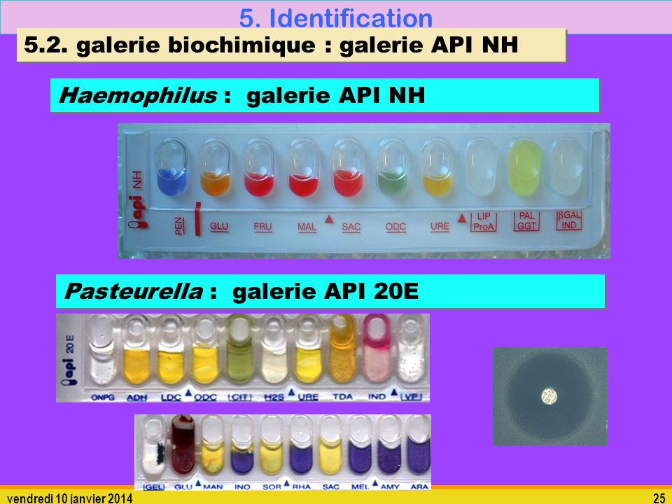5. Identification 5.2. galerie biochimique : galerie API NH