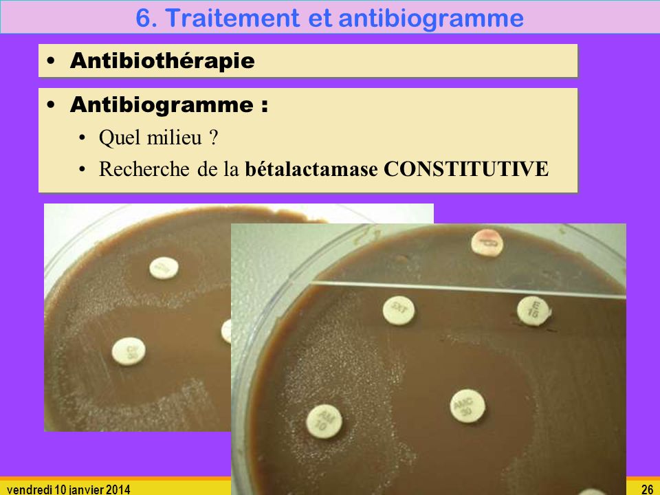 6. Traitement et antibiogramme