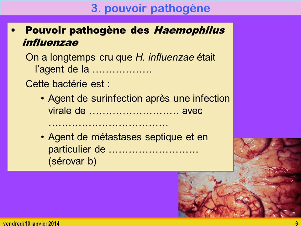 3. pouvoir pathogène Pouvoir pathogène des Haemophilus influenzae