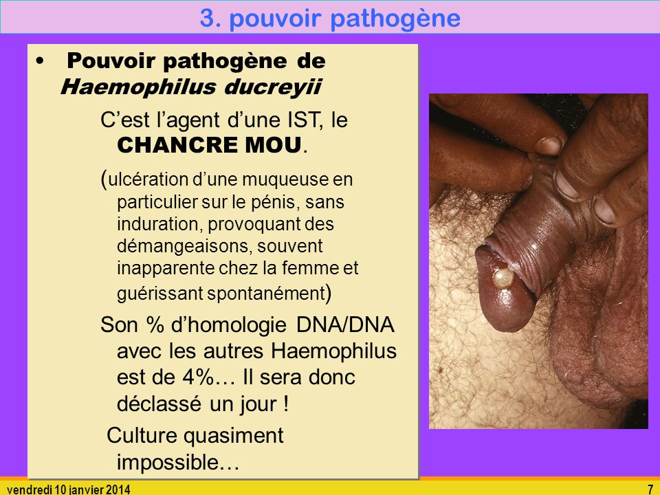 3. pouvoir pathogène Pouvoir pathogène de Haemophilus ducreyii