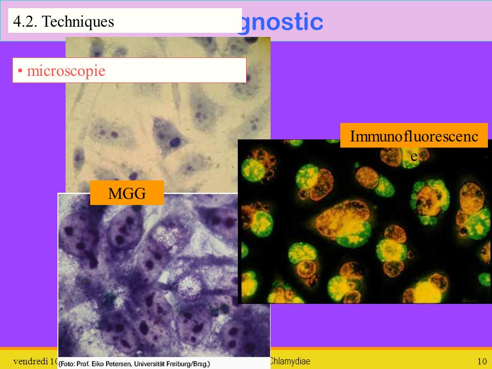 4. Diagnostic 4.2. Techniques microscopie Immunofluorescence MGG