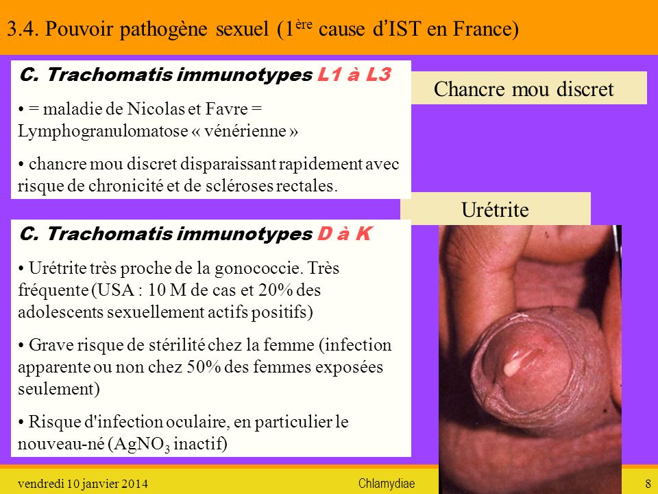 3.4. Pouvoir pathogène sexuel (1ère cause d’IST en France)