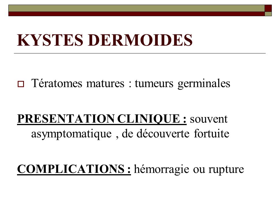 KYSTES DERMOIDES Tératomes matures : tumeurs germinales