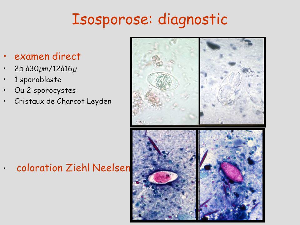 Isosporose: diagnostic