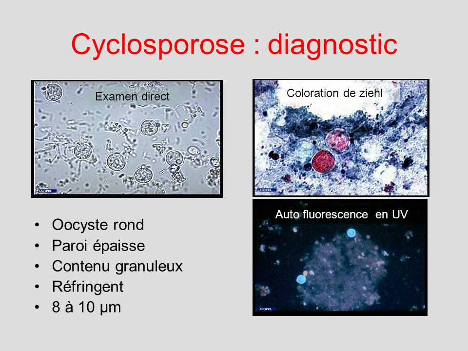 Cyclosporose : diagnostic
