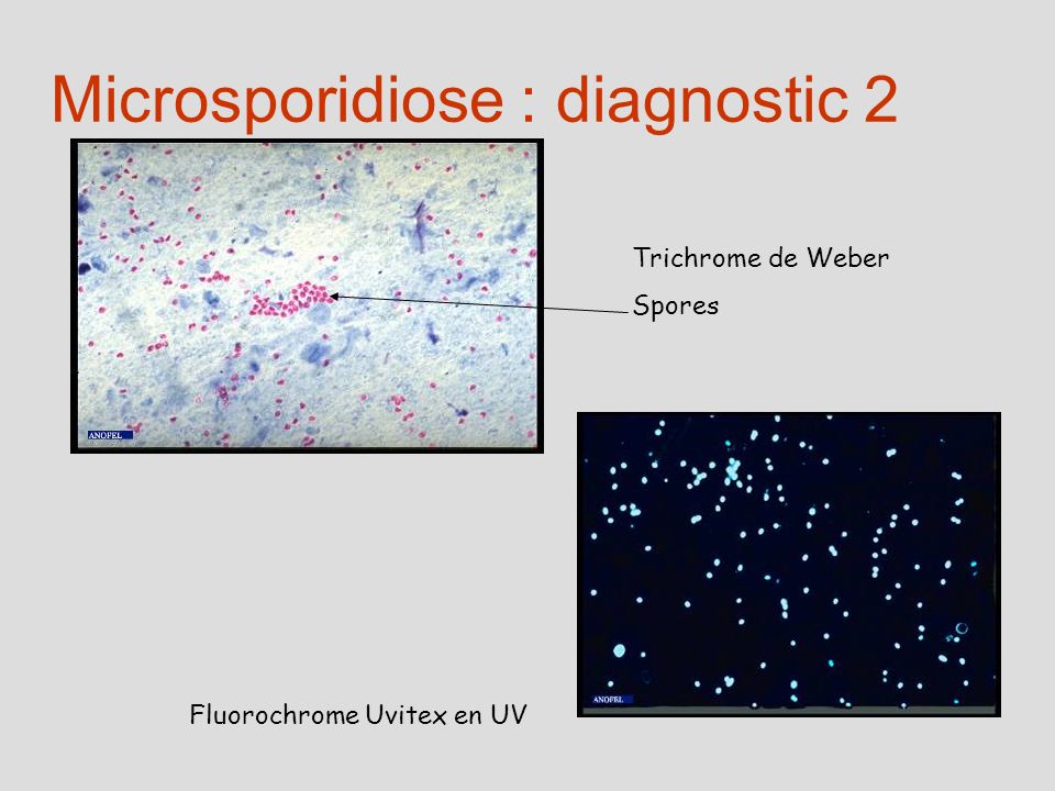 Microsporidiose : diagnostic 2