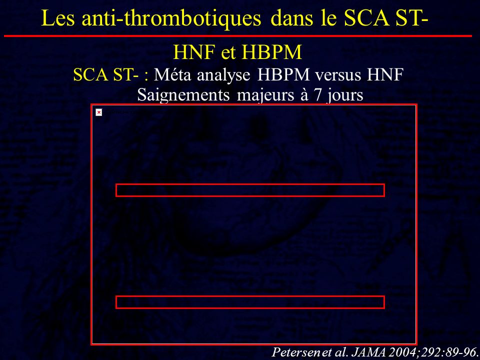 Les anti-thrombotiques dans le SCA ST-