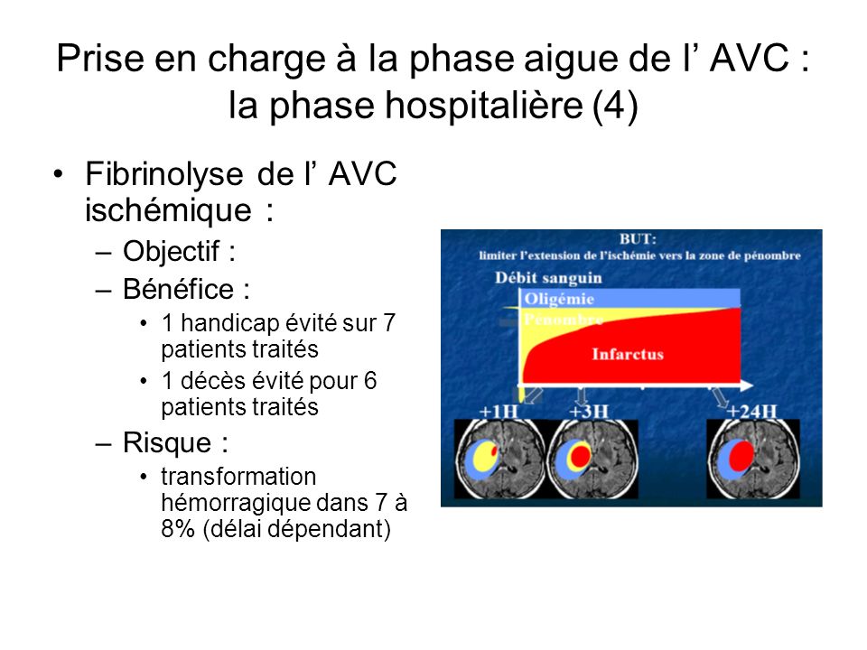 Prise en charge à la phase aigue de l’ AVC : la phase hospitalière (4)