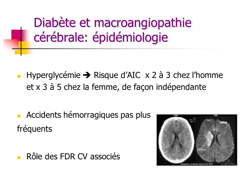 Diabète et macroangiopathie cérébrale: épidémiologie
