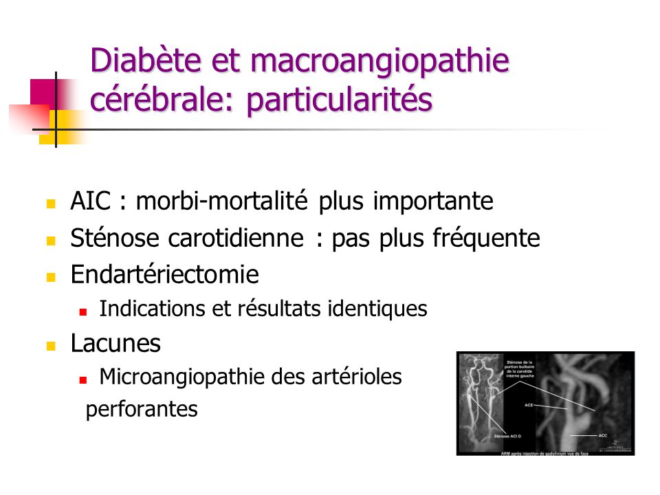 Diabète et macroangiopathie cérébrale: particularités