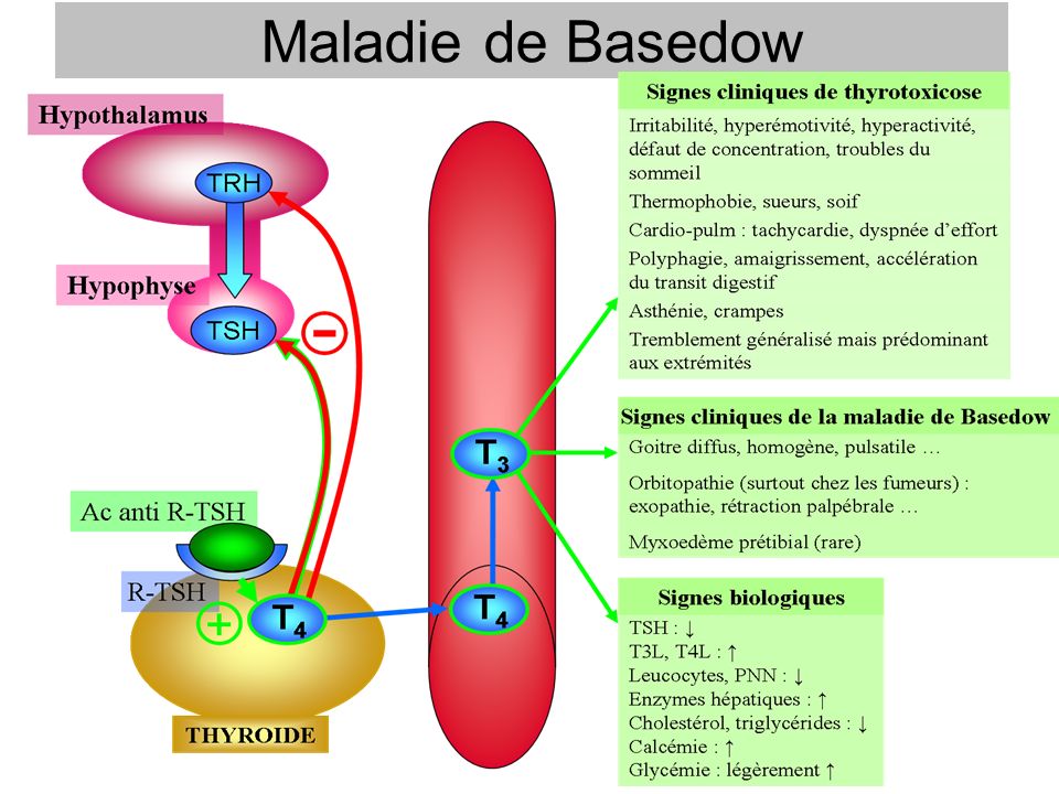 Présentation au sujet: "Cas cliniques Maladie de Basedow"- Transc...