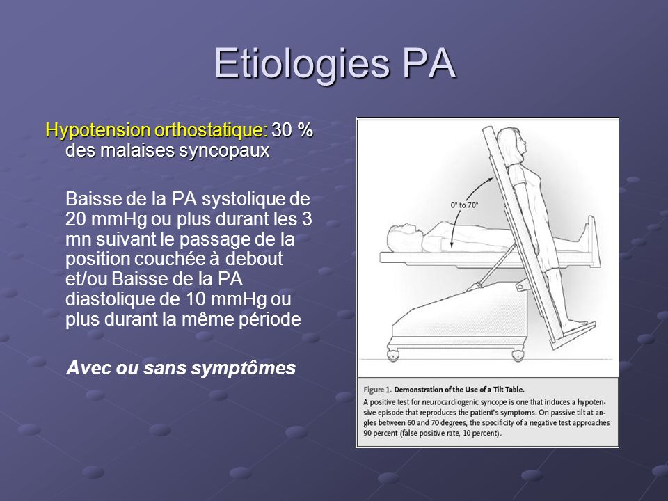 Etiologies PA Hypotension orthostatique: 30 % des malaises syncopaux