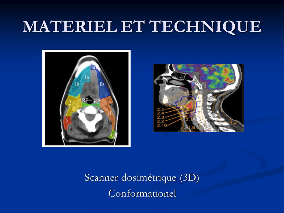 Scanner dosimétrique (3D)