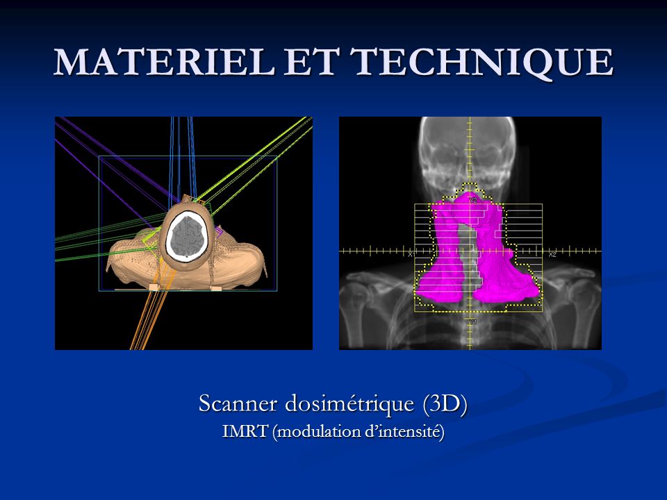 MATERIEL ET TECHNIQUE Scanner dosimétrique (3D)
