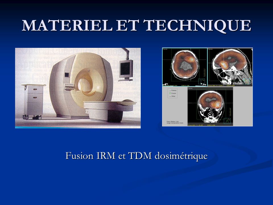 Fusion IRM et TDM dosimétrique