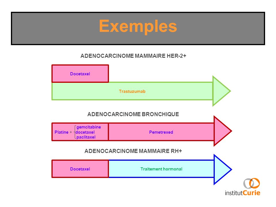 Exemples ADENOCARCINOME MAMMAIRE HER-2+ ADENOCARCINOME BRONCHIQUE