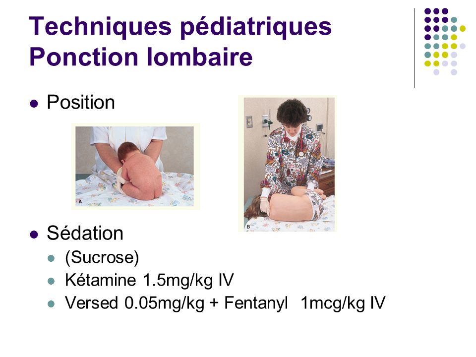 Ponction Lombaire Technique Pediatrie