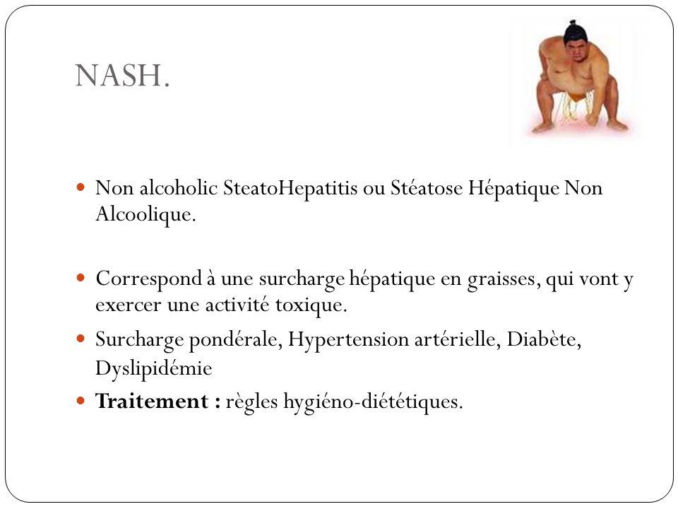 NASH. Non alcoholic SteatoHepatitis ou Stéatose Hépatique Non Alcoolique.