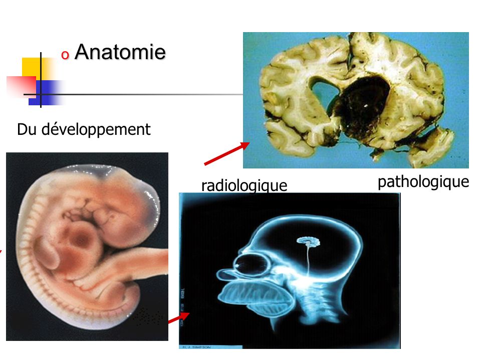Anatomie Du développement pathologique radiologique
