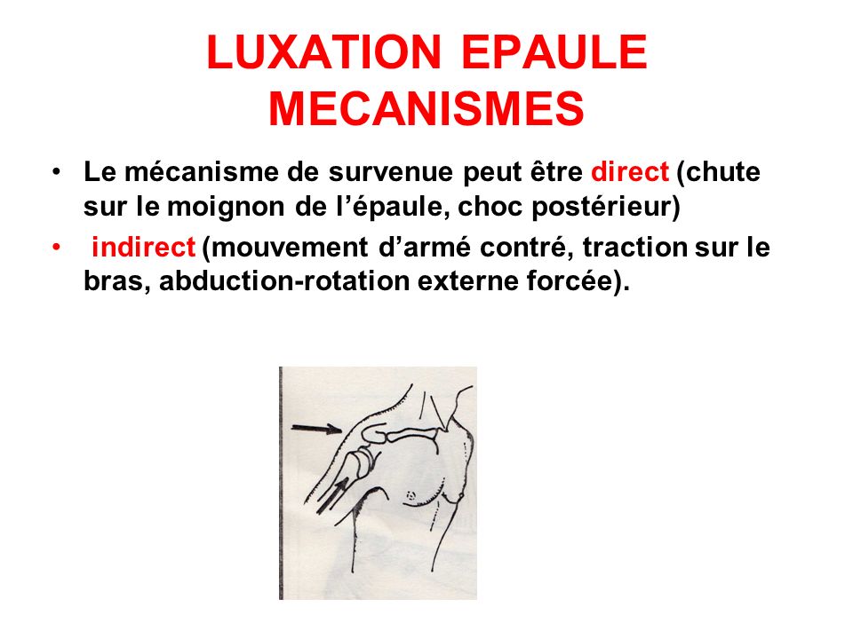 LUXATION EPAULE MECANISMES